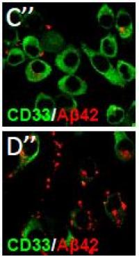 CD33 Over-Expressed or Inactivated and Beta-Amyloid