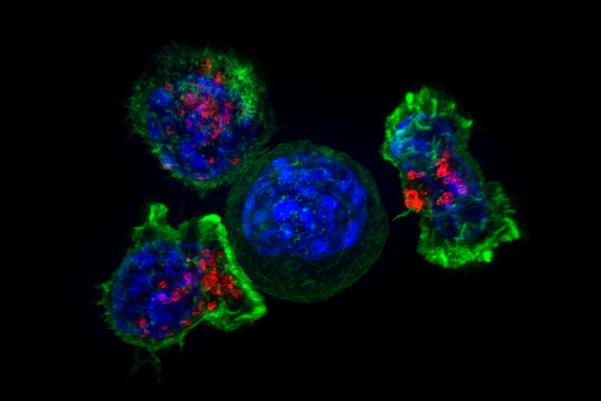 Killer T Cells Surrounding a Cancer Cell