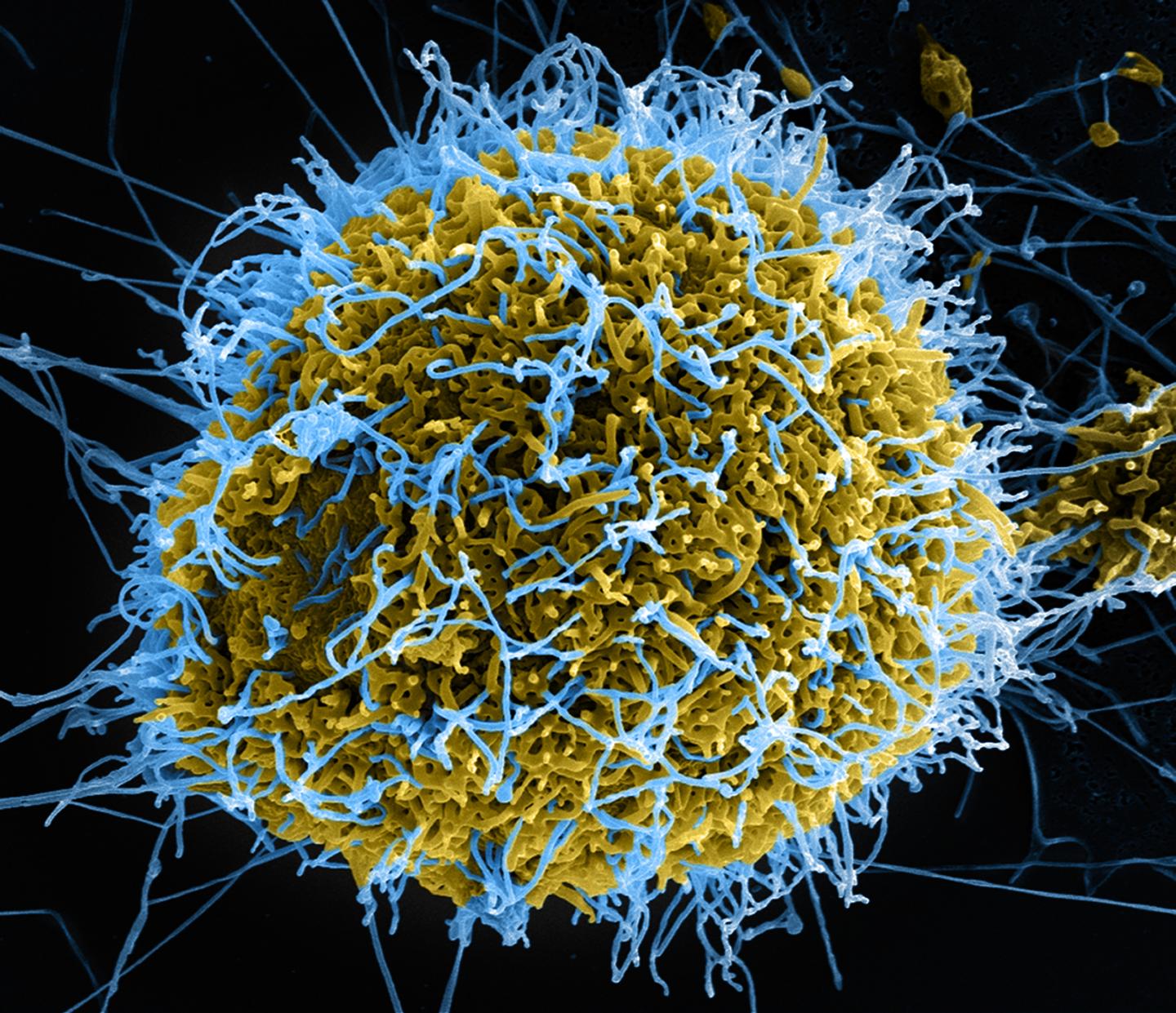 How the Human Immune System Protects Against Ebola