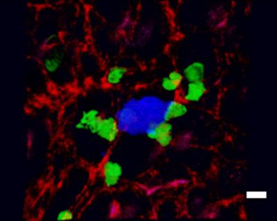 Macrophages Attaching to Tumor Cell