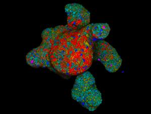 Human intestinal organoid