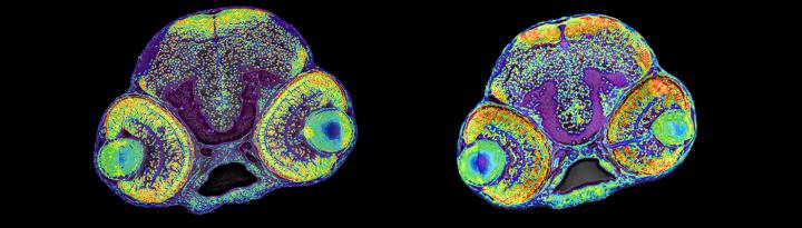 Investigating the role of RRP7A in brain development