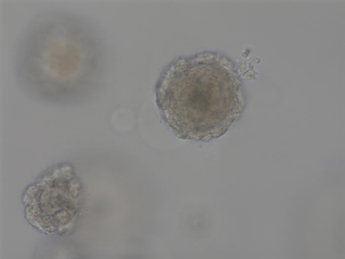 Tongue Cancer Organoids (TCO)