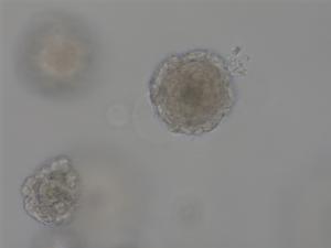 Tongue Cancer Organoids (TCO)