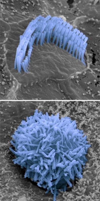 Hair Cells