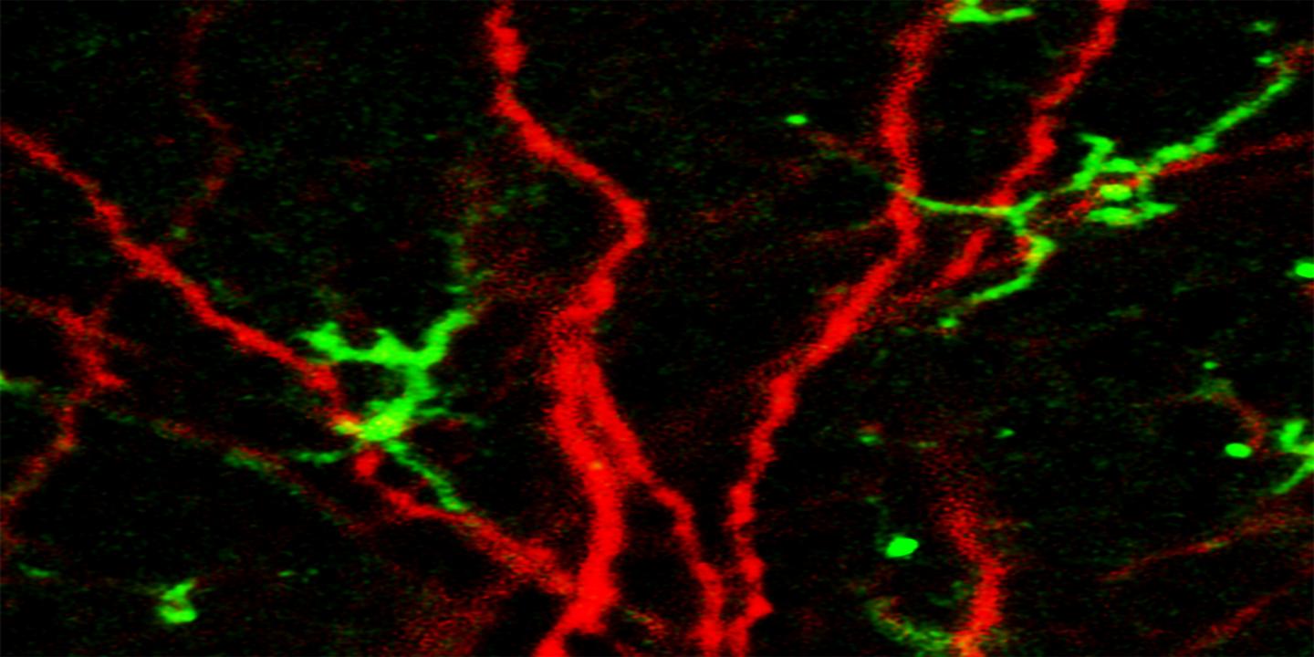 ApoE-Expressing Astrocytes