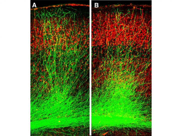 Schizophrenia Model Shows Stunted Growth of Neurons