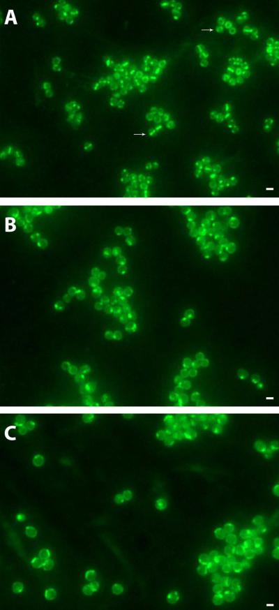 Outsmarting Drug-Resistant MRSA (2 of 2)