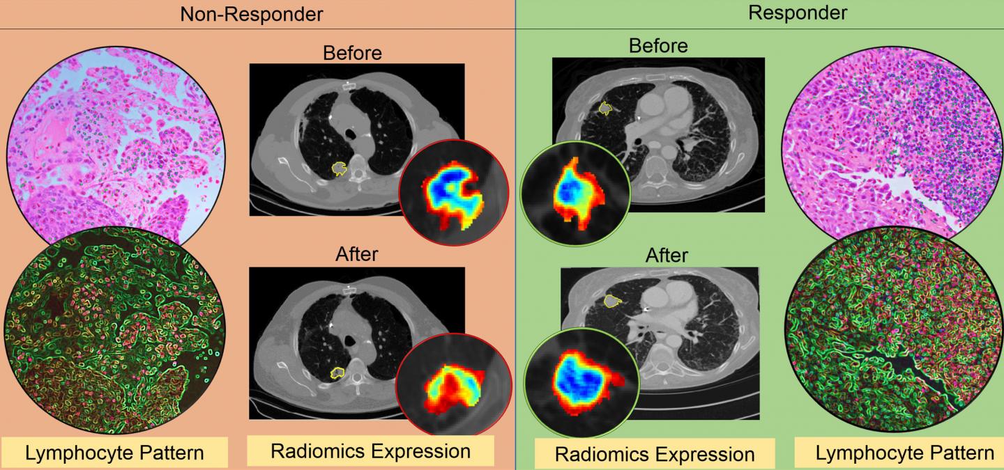 Differential Expression in Radiomic and Pathomic Attributes between Immunotherapy Responders