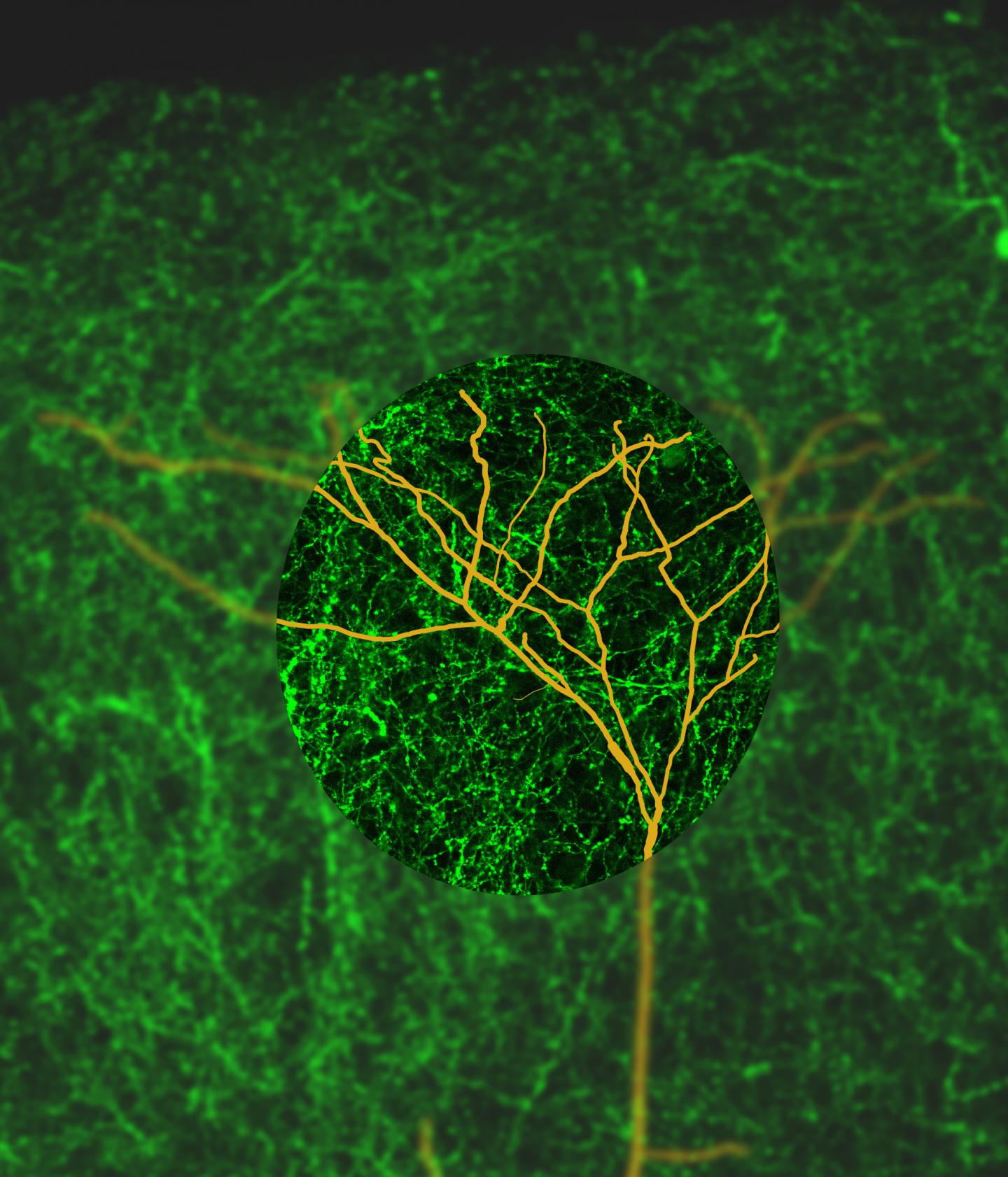 Distal Dendrites Amongst a Sea of Cholinergic Axons