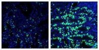 Salk Evans FXR Microscopy