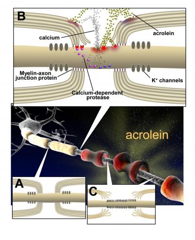 How Acrolein May Damage Nerve Insulation
