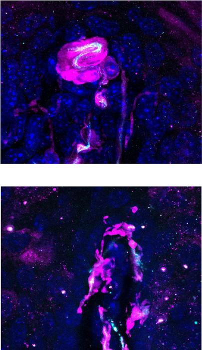 Touch neurons are "born" unspecialized but go on to develop specialization based on cues from the skin