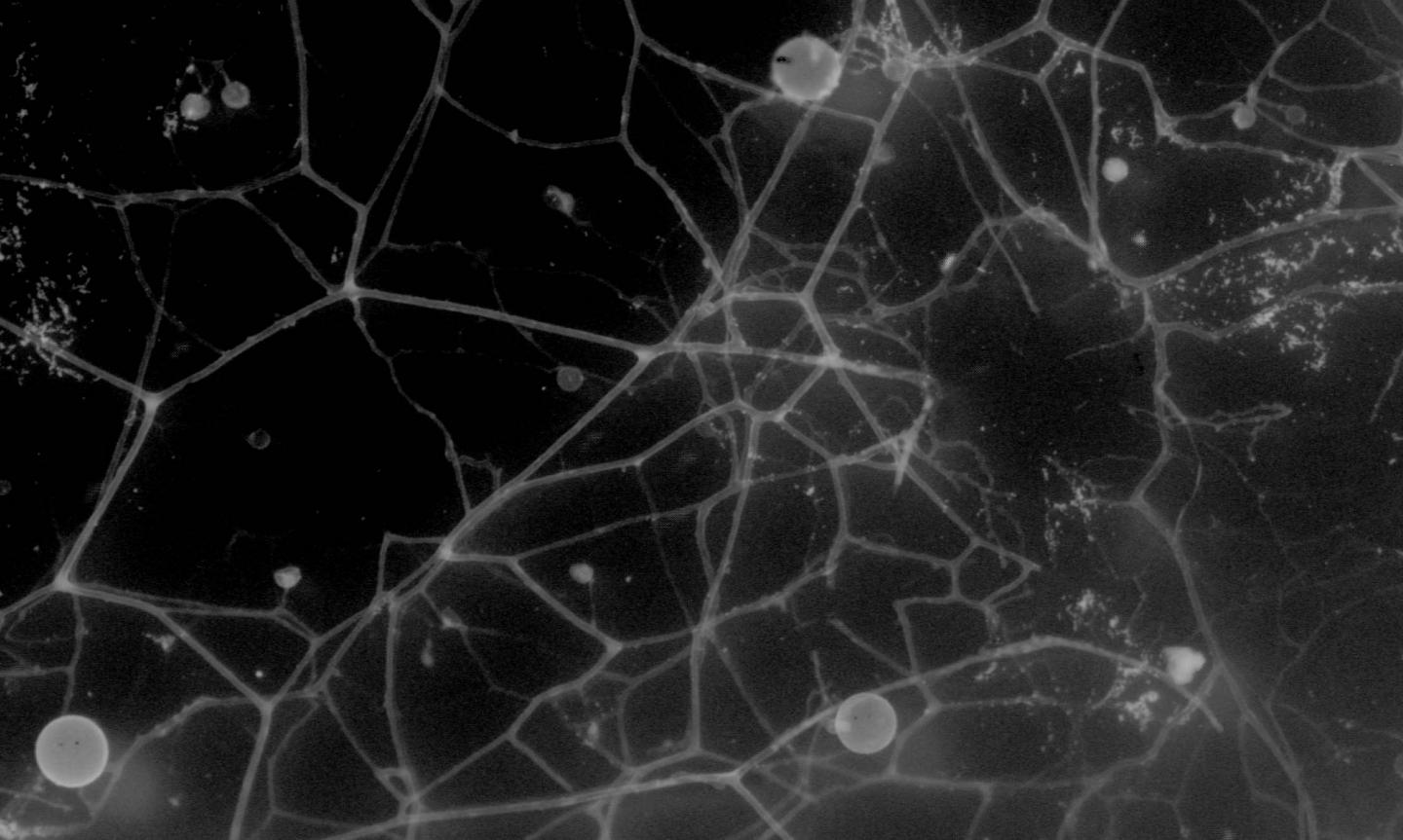B&W microscopic image of AM fungal hyphae