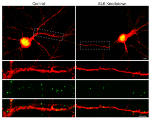 The nerve cell