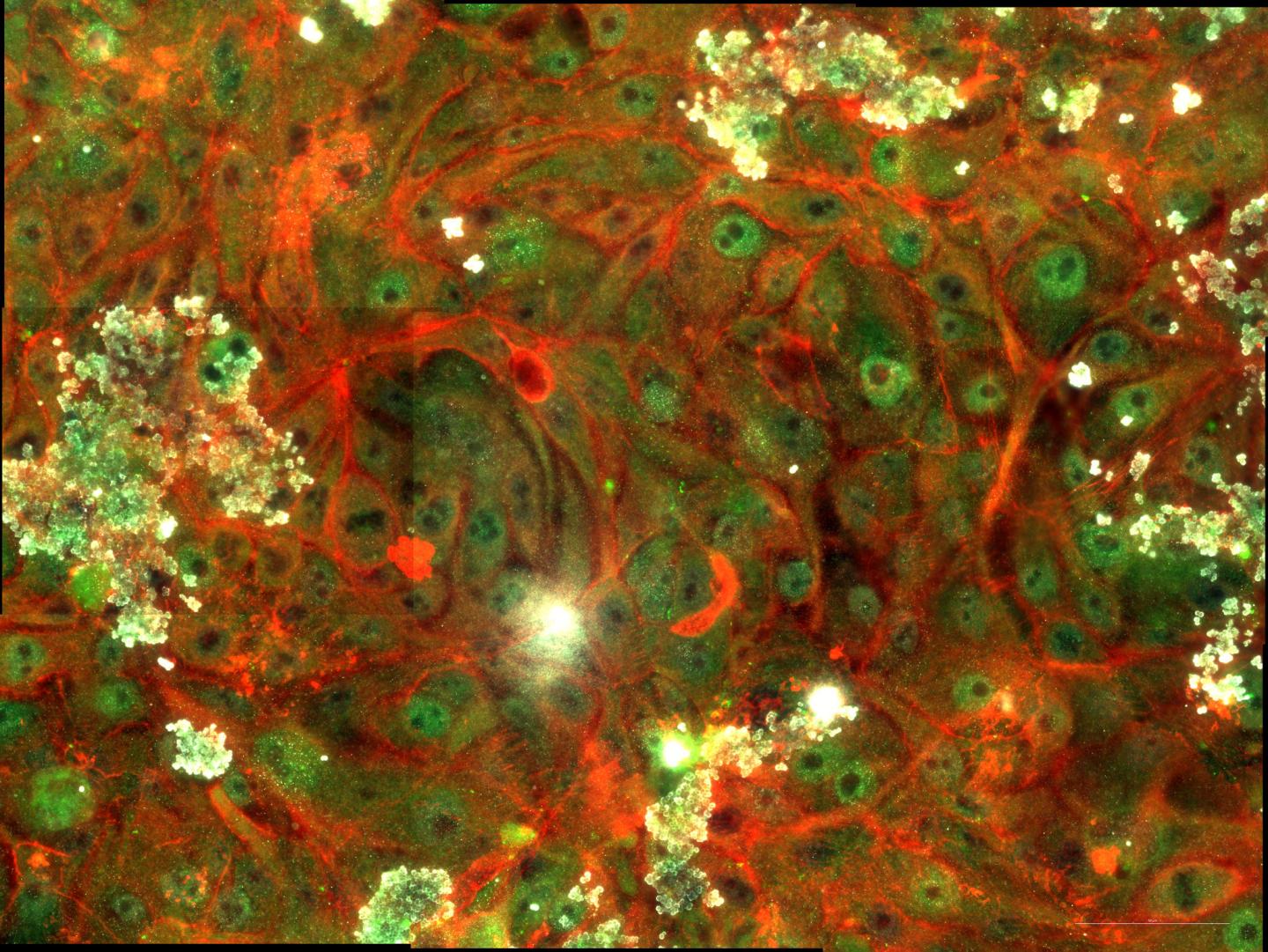 Scientists Use Modelling to Show the Role of Metabolism and Signaling in Cancer Metastasis