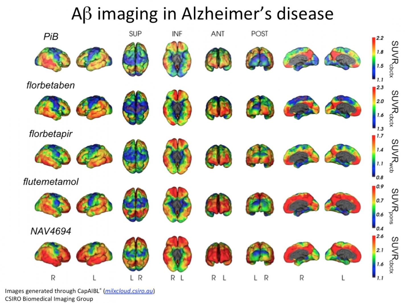 Imaging in Alzheimers with CapAIBL