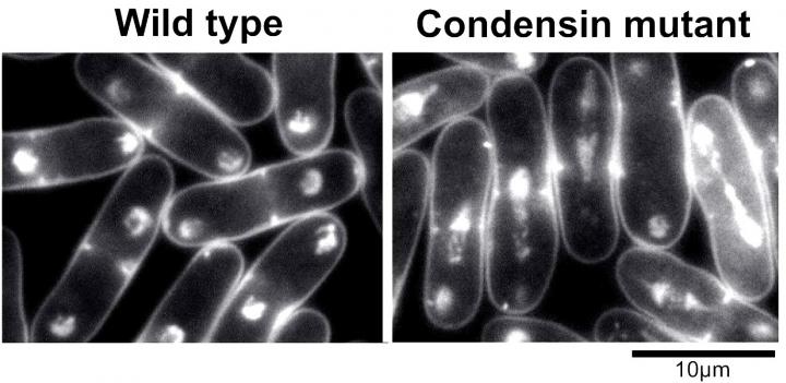 Condensin Is a Key Player in Successful Chromosome Segregation