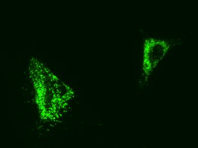 Biomaterials Get Stem Cells to Commit to a Bony Future (2 of 2)