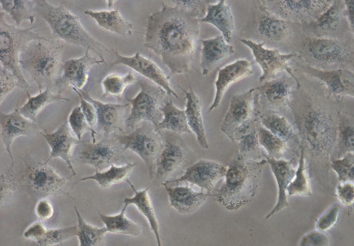 Human Lung Adeconarcinoma Cell Used in This Research