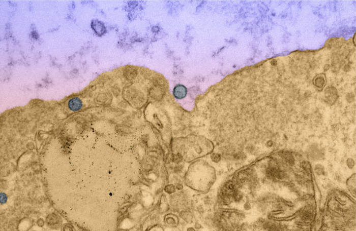 SARS-CoV-2 virus particles