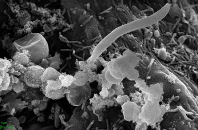 <I>Plasmodium</I> Sporozoite