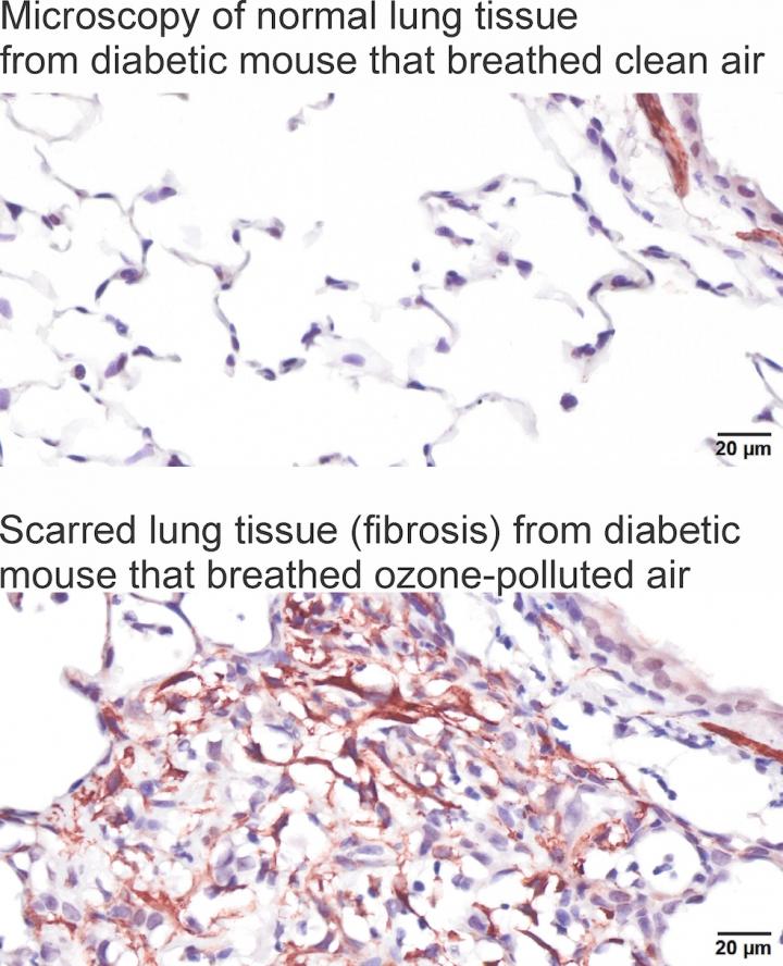 Lung comparison