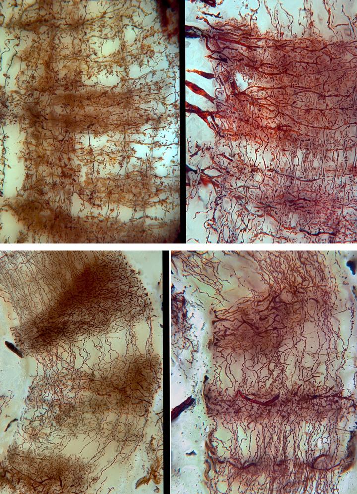 Similar Mushroom Body Architecture