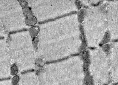 Muscle Cell Architecture in Transgenic Mice that Lack ACTA1 but Express Human ACTC
