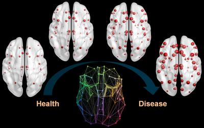 Epidemic Spreading and Neurodegenerative Progression