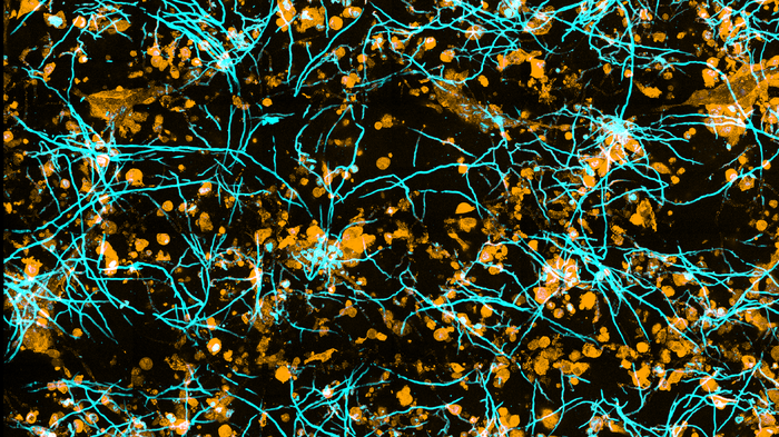 Fungal hyphae invade lung epithelial cells