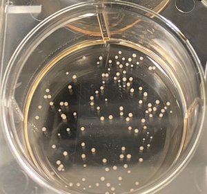 Brain organoid