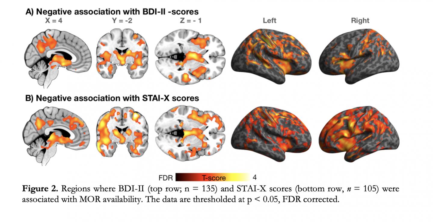 Brain Regions