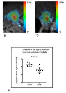 Kidney sodium magnetic resonance images of m+/m+ (BKS.Cg-m+/m+/Jcl) and db/db mice (BKS.Cg-Leprdb+/+ Leprdb/Jcl) (N=7 each).