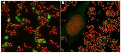 Bacterial Expression of <i>Escherichia coli</i>