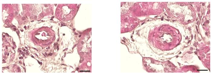 Kidney blood vessels