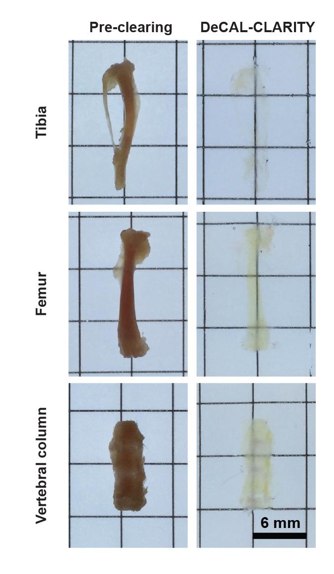 In the Clear: New Imaging Technique Makes Bones Transparent (4 of 6)