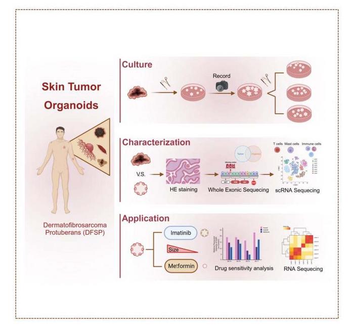 Development and Application of DFSP Skin Tumor Organoids