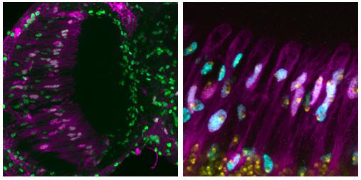 Glial Cells with Extra Genome Copies