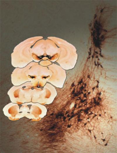 Cross Sections of a Mouse Brain