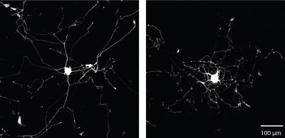 Neurons Develop More Branched Growth in Experiment (1 of 2)