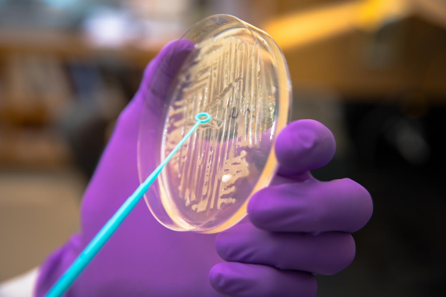 <i>E. coli</i> Carrying mcr-1 and ndm-5