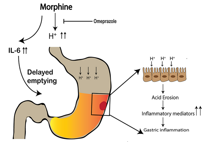 Schematic diagram of morphine-induced delayed gastric emptying and gastric inflammation