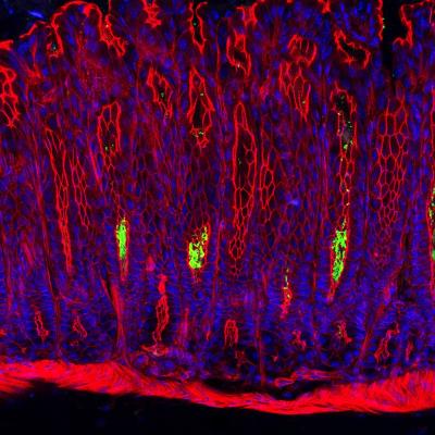 Gastric Epithelium with Helicobacter Pylori