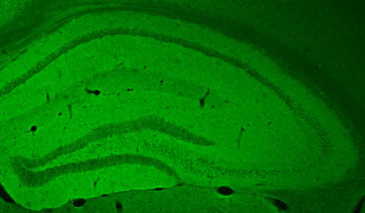 Targeting the Hippocampus in Sleep Deprivation