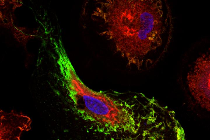 TREM2 and MS4A4A Cell