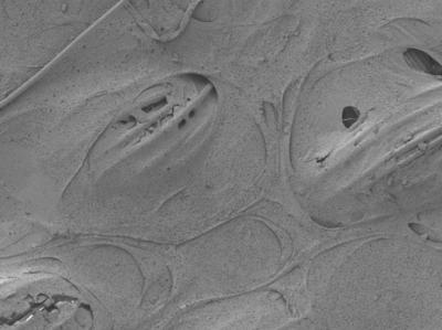 Scaffolding with Hydrogel