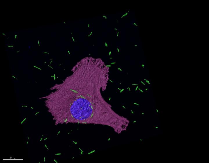 Confocal fluorescence image of gold nanotures (green) in mesothelioma cells