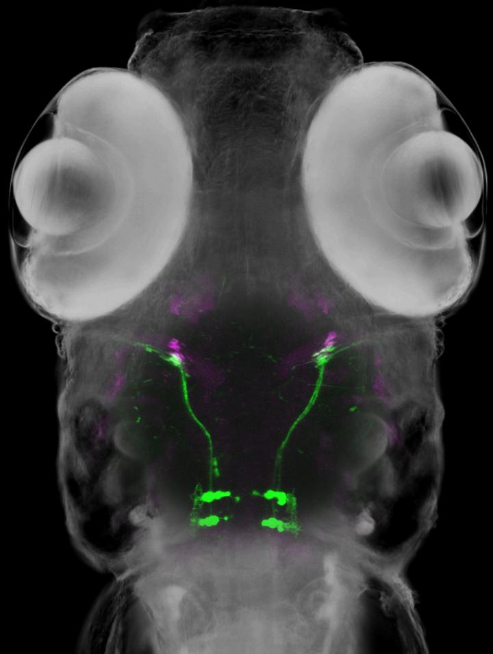 Looking into the Brain