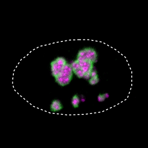 Nucleus of a cell in BPTA syndrome